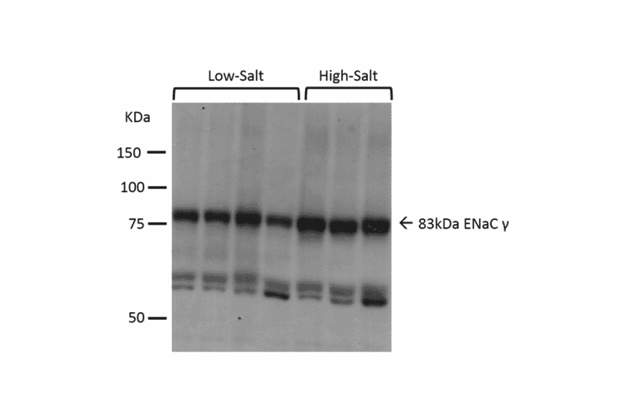 Western Blot - Anti-SCNN1G Antibody (A305215) - Antibodies.com