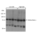 Western Blot - Anti-SCNN1G Antibody (A305215) - Antibodies.com