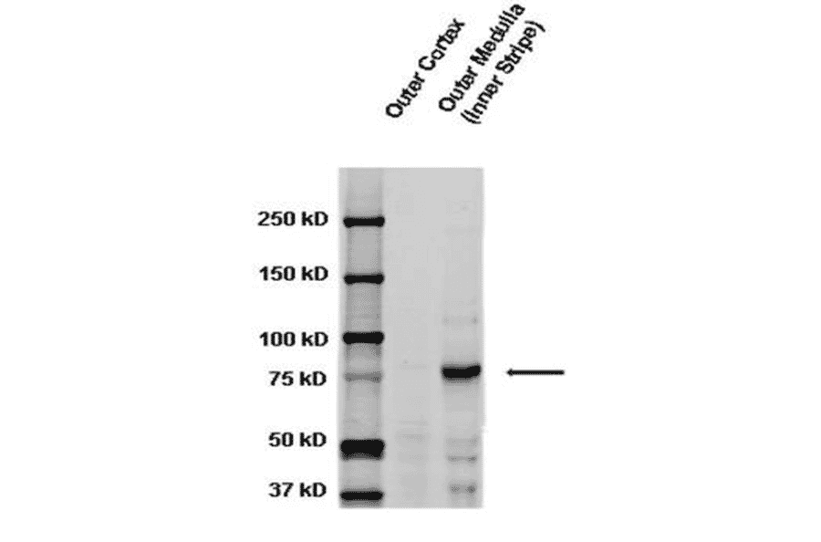 Western Blot - Anti-SCNN1G Antibody (A305215) - Antibodies.com