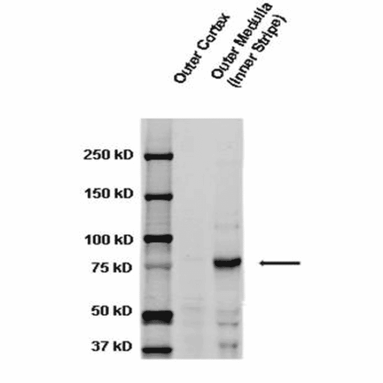 Western Blot - Anti-SCNN1G Antibody (A305215) - Antibodies.com