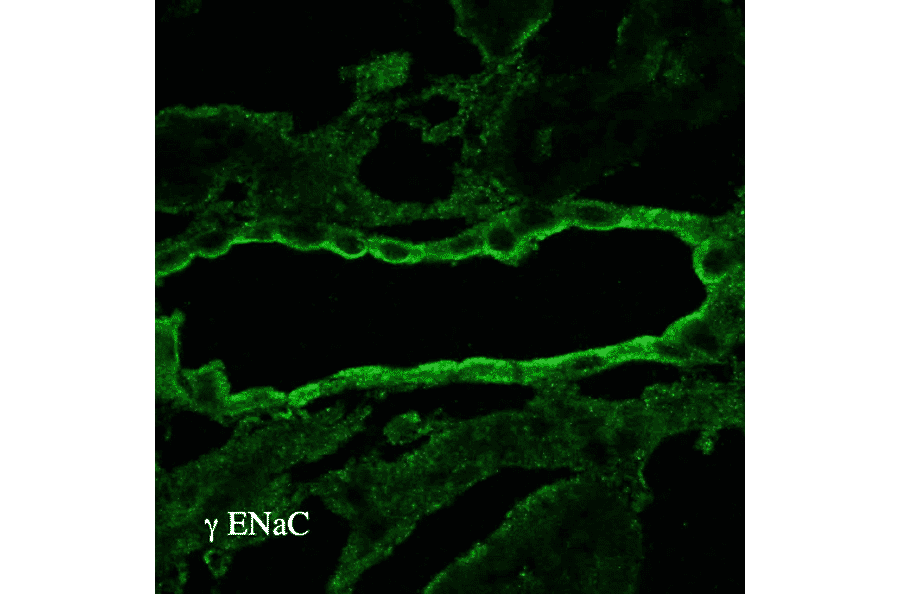 Immunohistochemistry - Anti-SCNN1G Antibody (A305215) - Antibodies.com