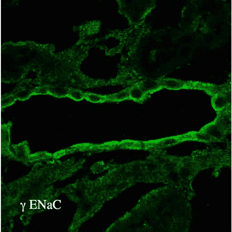 Immunohistochemistry - Anti-SCNN1G Antibody (A305215) - Antibodies.com