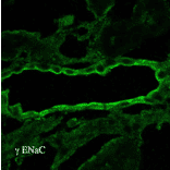 Immunohistochemistry - Anti-SCNN1G Antibody (A305215) - Antibodies.com