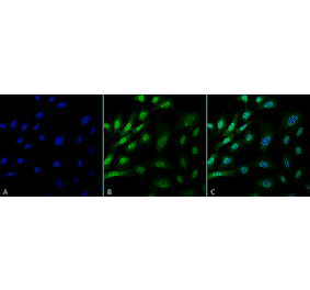 Immunocytochemistry/Immunofluorescence - Anti-Ubiquitin Antibody [FK1] (A305216) - Antibodies.com