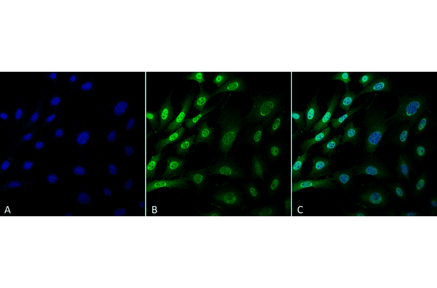 Immunocytochemistry/Immunofluorescence - Anti-Ubiquitin Antibody [FK1] (A305216) - Antibodies.com