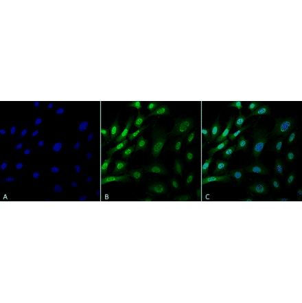 Immunocytochemistry/Immunofluorescence - Anti-Ubiquitin Antibody [FK1] (A305216) - Antibodies.com