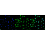 Immunocytochemistry/Immunofluorescence - Anti-Ubiquitin Antibody [FK1] (A305216) - Antibodies.com