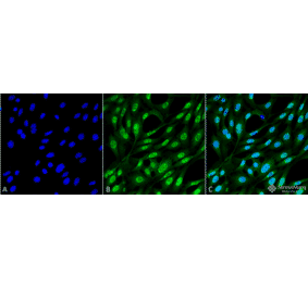 Immunocytochemistry/Immunofluorescence - Anti-Ubiquitin Antibody [FK2] (A305218) - Antibodies.com