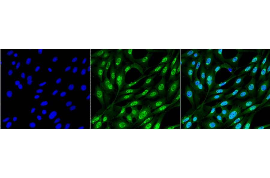 Immunocytochemistry/Immunofluorescence - Anti-Ubiquitin Antibody [FK2] (A305218) - Antibodies.com