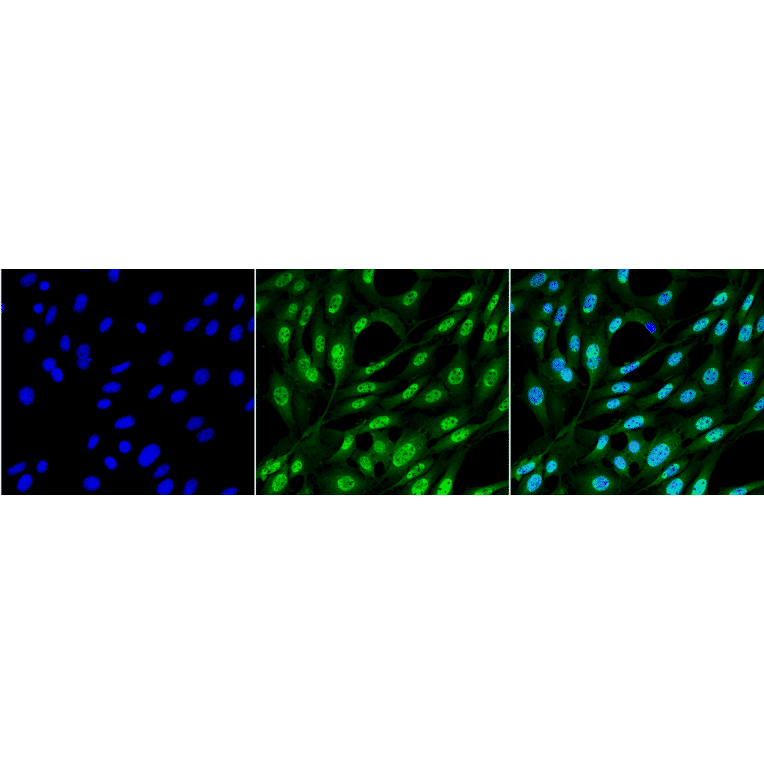 Immunocytochemistry/Immunofluorescence - Anti-Ubiquitin Antibody [FK2] (A305218) - Antibodies.com