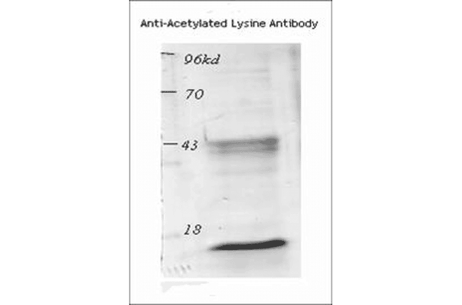 Western Blot - Anti-Acetylated Lysine Antibody (A305219) - Antibodies.com