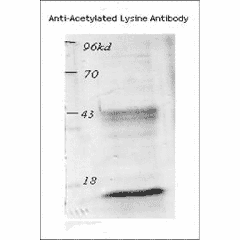 Western Blot - Anti-Acetylated Lysine Antibody (A305219) - Antibodies.com