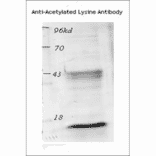 Western Blot - Anti-Acetylated Lysine Antibody (A305219) - Antibodies.com