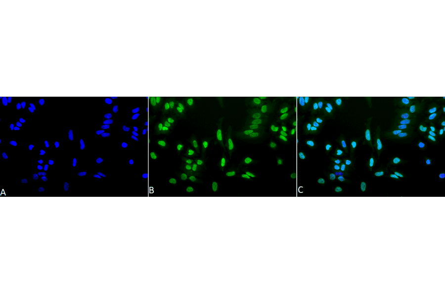 Immunocytochemistry/Immunofluorescence - Anti-Acetylated Lysine Antibody (A305219) - Antibodies.com