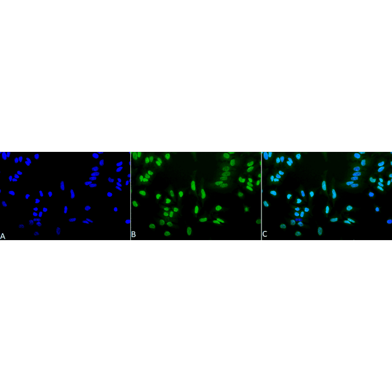 Immunocytochemistry/Immunofluorescence - Anti-Acetylated Lysine Antibody (A305219) - Antibodies.com