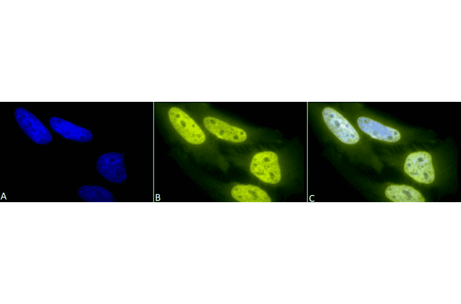 Immunocytochemistry/Immunofluorescence - Anti-Acetylated Lysine Antibody (A305219) - Antibodies.com