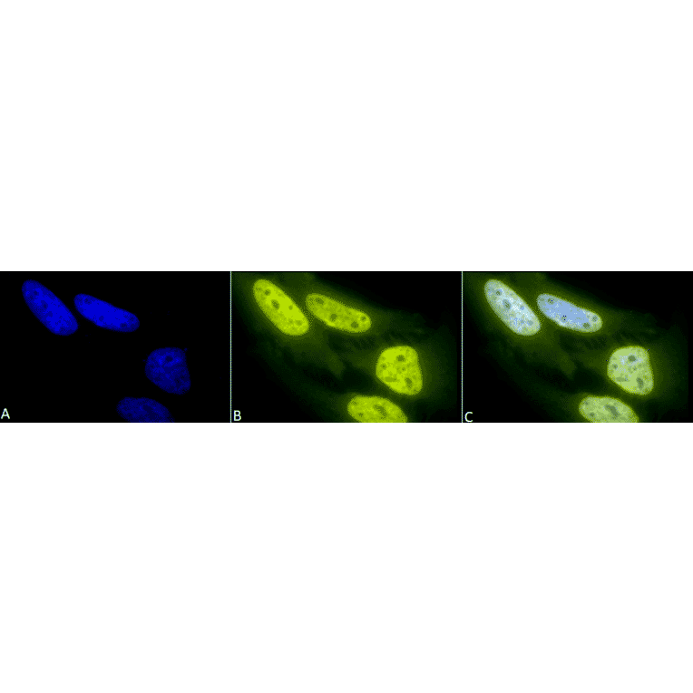 Immunocytochemistry/Immunofluorescence - Anti-Acetylated Lysine Antibody (A305219) - Antibodies.com
