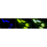 Immunocytochemistry/Immunofluorescence - Anti-Acetylated Lysine Antibody (A305219) - Antibodies.com