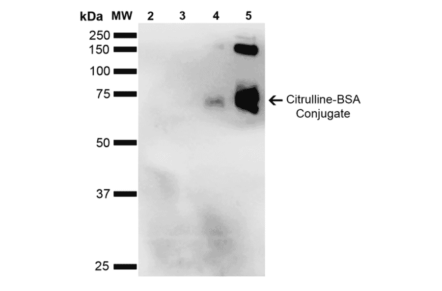 Western Blot - Anti-Citrulline Antibody [2D3.1] (A305223) - Antibodies.com