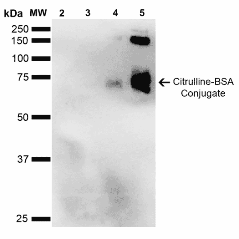 Western Blot - Anti-Citrulline Antibody [2D3.1] (A305223) - Antibodies.com