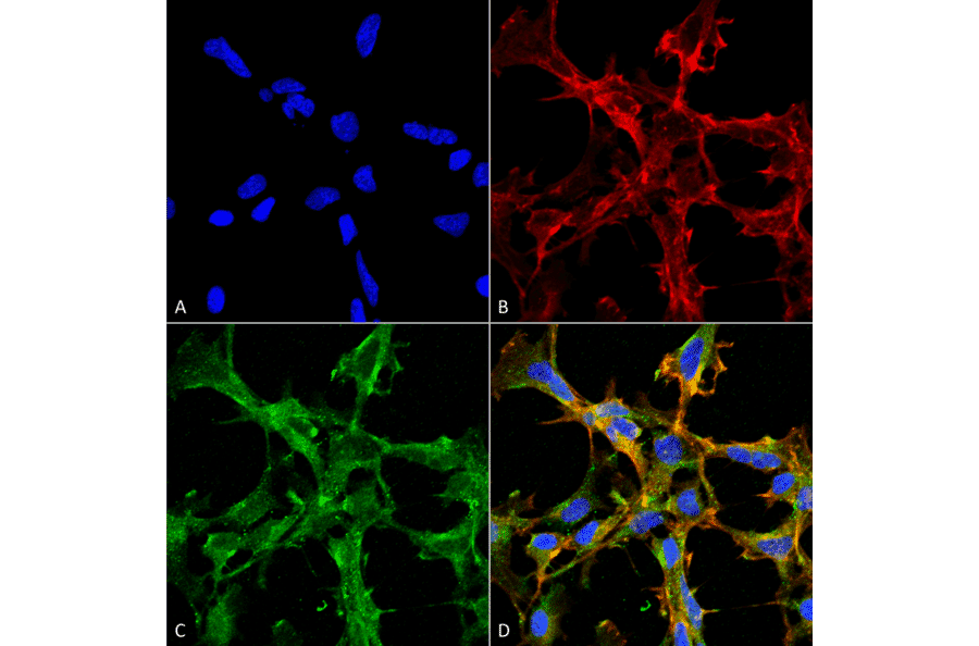 Immunocytochemistry/Immunofluorescence - Anti-Citrulline Antibody [2D3.1] (A305223) - Antibodies.com