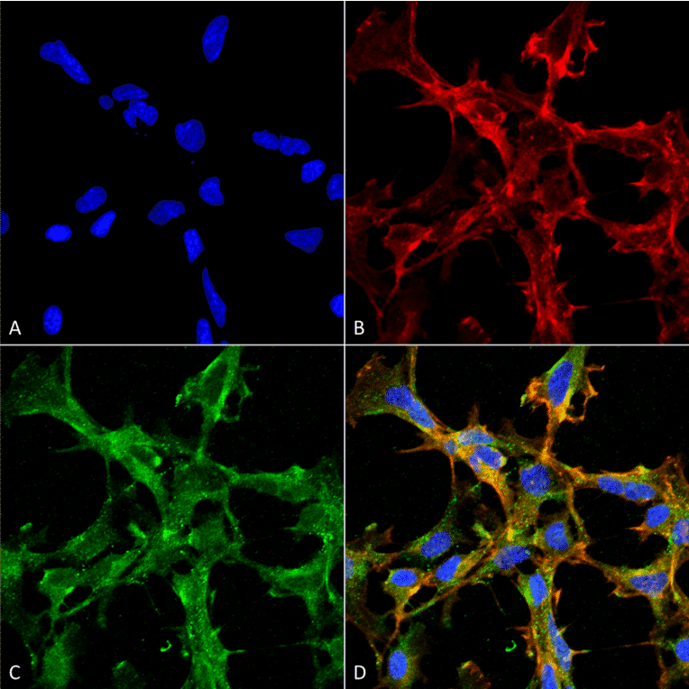 Immunocytochemistry/Immunofluorescence - Anti-Citrulline Antibody [2D3.1] (A305223) - Antibodies.com