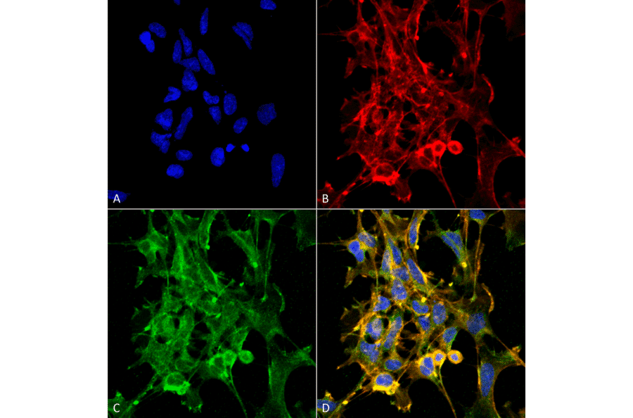 Immunocytochemistry/Immunofluorescence - Anti-Citrulline Antibody [6C2.1] (A305226) - Antibodies.com