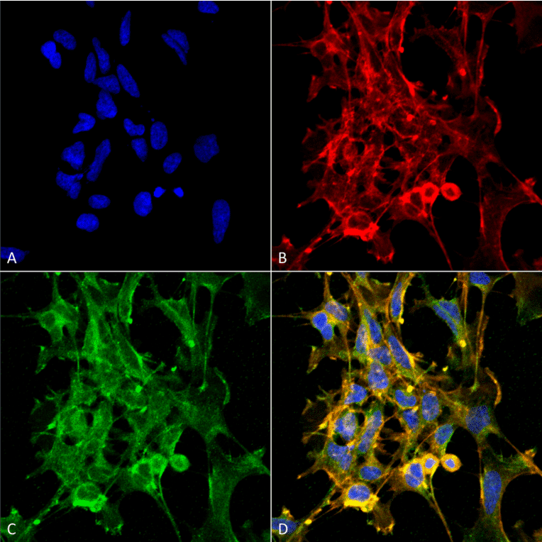 Immunocytochemistry/Immunofluorescence - Anti-Citrulline Antibody [6C2.1] (A305226) - Antibodies.com