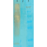 Western Blot - Anti-Acetylated Lysine Antibody [7F8] (A305227) - Antibodies.com