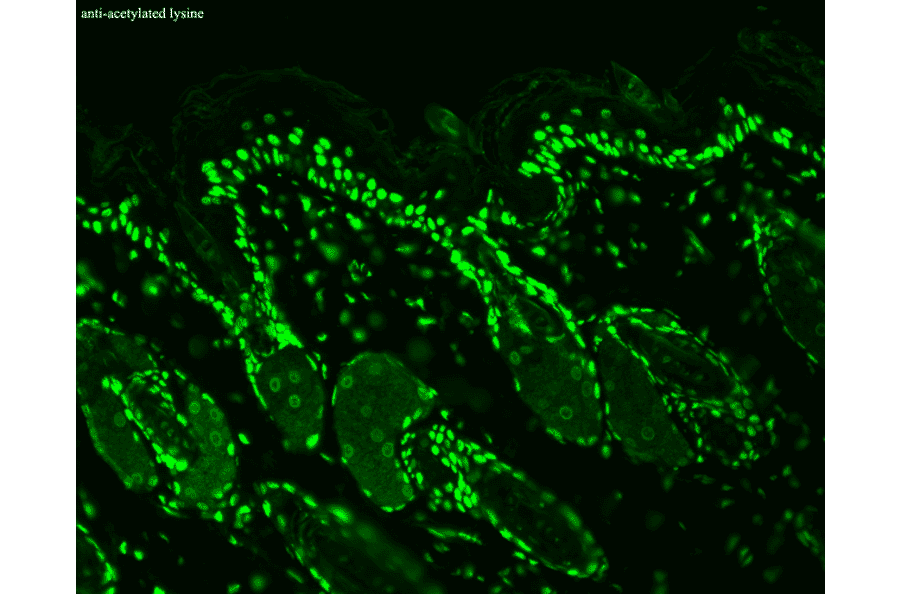 Immunohistochemistry - Anti-Acetylated Lysine Antibody [7F8] (A305227) - Antibodies.com