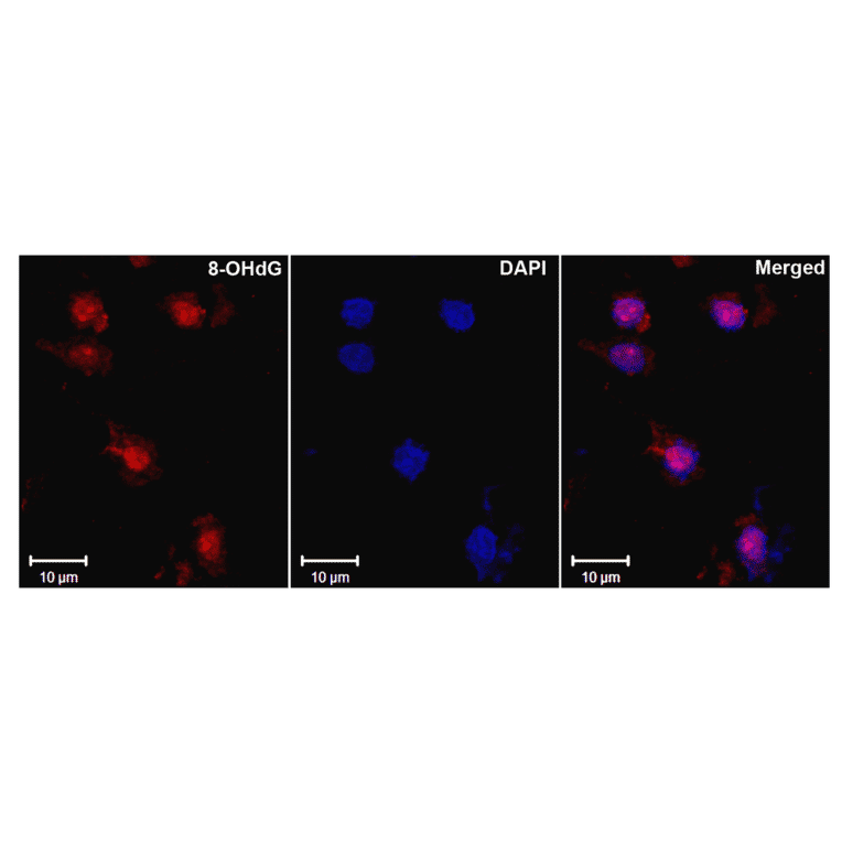 Immunohistochemistry - Anti-DNA/RNA Damage Antibody [15A3] (A305228) - Antibodies.com