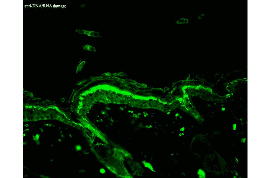 Immunohistochemistry - Anti-DNA/RNA Damage Antibody [15A3] (A305228) - Antibodies.com