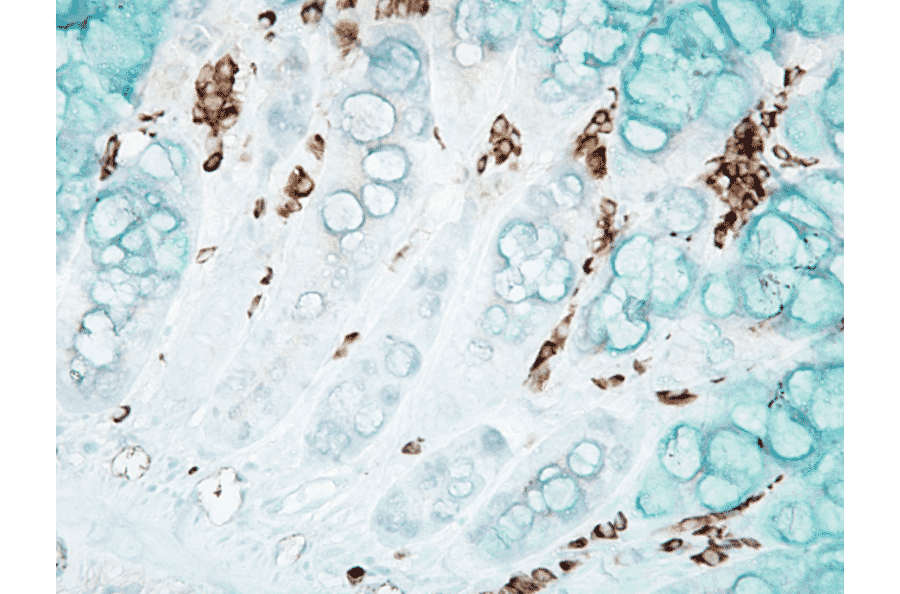 Immunohistochemistry - Anti-DNA/RNA Damage Antibody [15A3] (A305228) - Antibodies.com