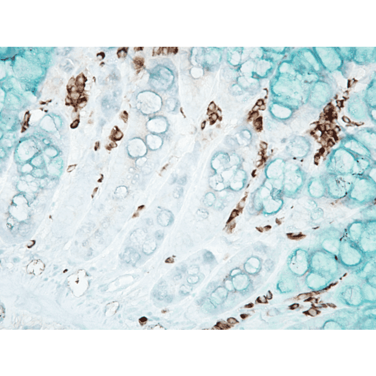 Immunohistochemistry - Anti-DNA/RNA Damage Antibody [15A3] (A305228) - Antibodies.com