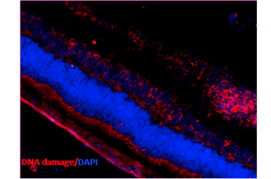 Immunohistochemistry - Anti-DNA/RNA Damage Antibody [15A3] (A305228) - Antibodies.com