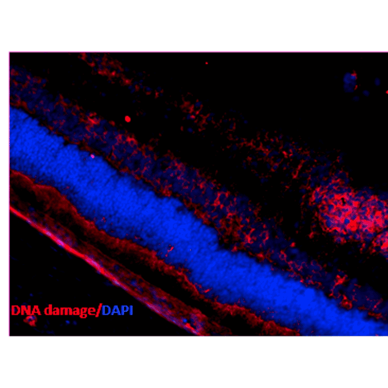 Immunohistochemistry - Anti-DNA/RNA Damage Antibody [15A3] (A305228) - Antibodies.com