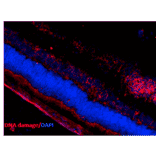 Immunohistochemistry - Anti-DNA/RNA Damage Antibody [15A3] (A305228) - Antibodies.com