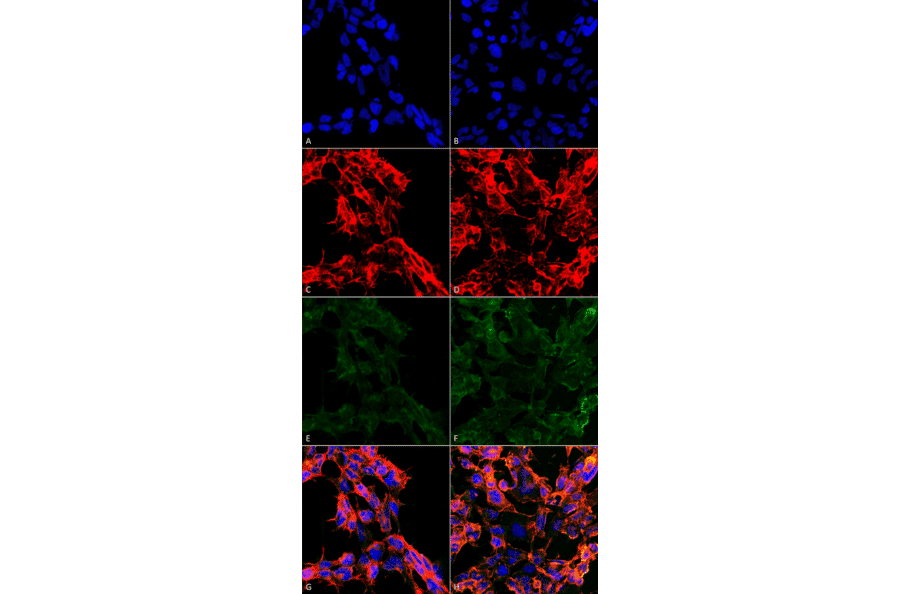 Immunocytochemistry/Immunofluorescence - Anti-7-Ketocholesterol Antibody [3F7] (A305232) - Antibodies.com