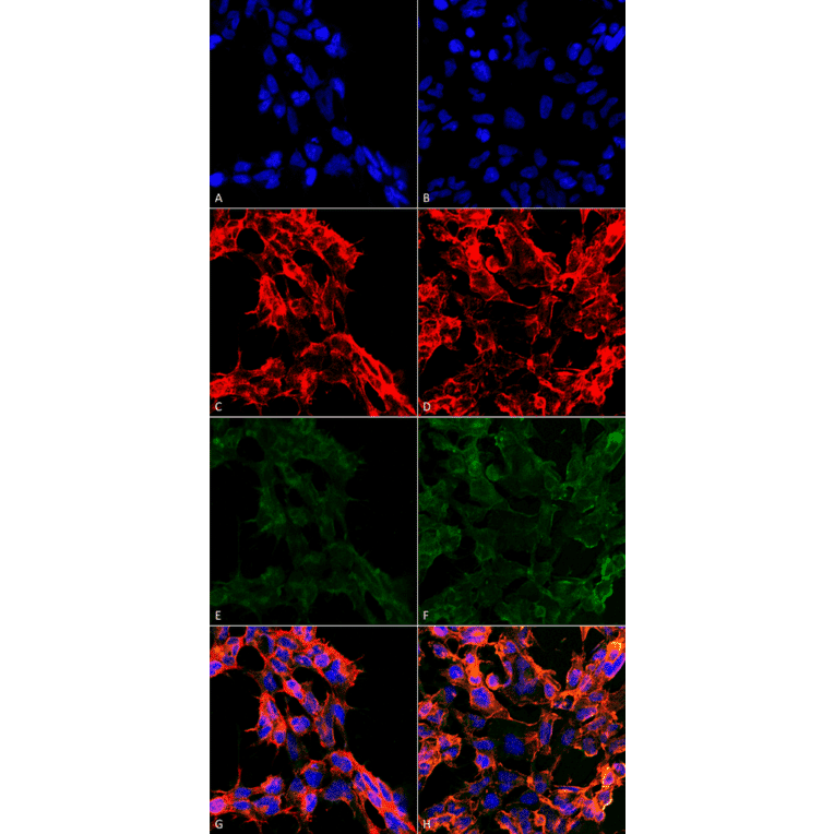 Immunocytochemistry/Immunofluorescence - Anti-7-Ketocholesterol Antibody [3F7] (A305232) - Antibodies.com