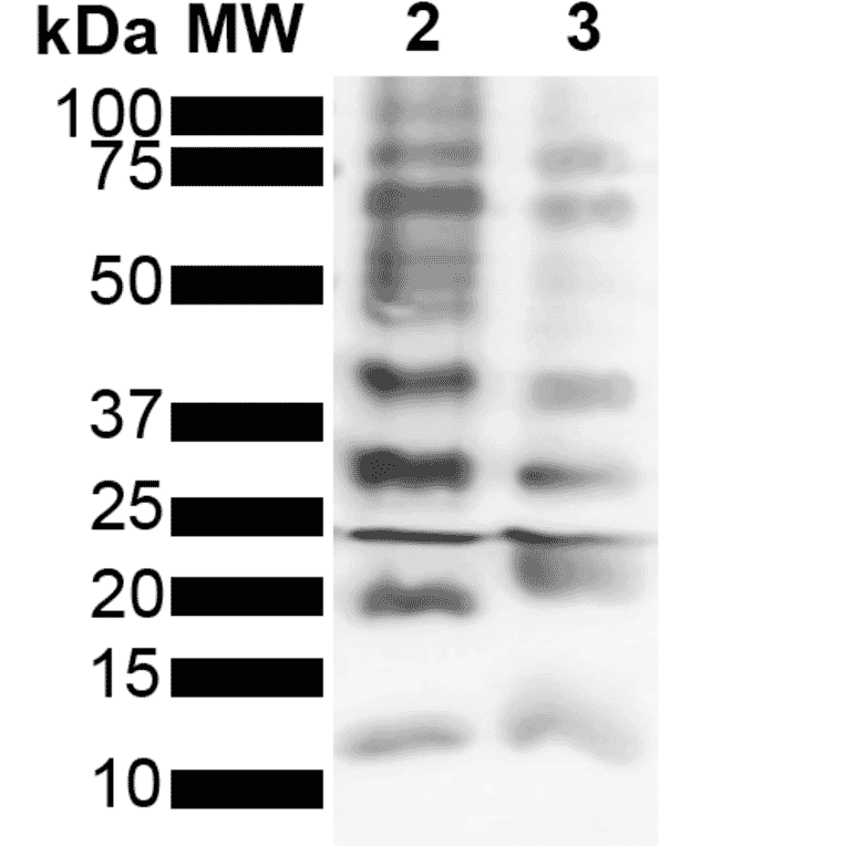 Western Blot - Anti-Ubiquitin Antibody [FK2] (A305234) - Antibodies.com