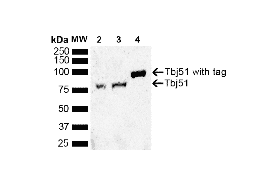 Western Blot - Anti-Tbj51 Antibody (A305238) - Antibodies.com
