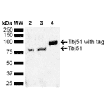 Western Blot - Anti-Tbj51 Antibody (A305238) - Antibodies.com
