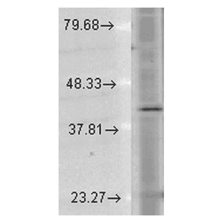 Western Blot - Anti-Rhodopsin Antibody [1D4] (A305239) - Antibodies.com