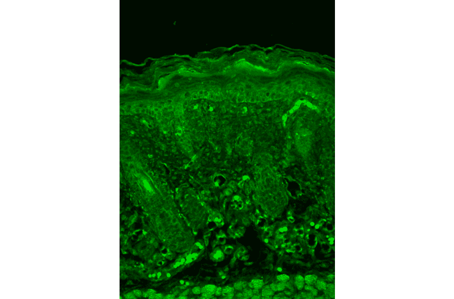 Immunohistochemistry - Anti-Rhodopsin Antibody [1D4] (A305239) - Antibodies.com