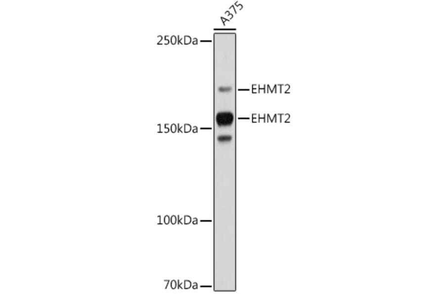 Western Blot - Anti-EHMT2/G9A Antibody [ARC2470] (A305253) - Antibodies.com