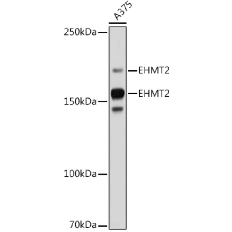 Western Blot - Anti-EHMT2/G9A Antibody [ARC2470] (A305253) - Antibodies.com