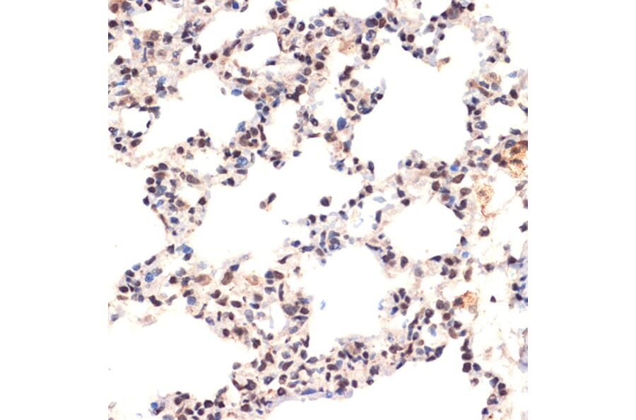 Immunohistochemistry - Anti-EHMT2/G9A Antibody [ARC2470] (A305253) - Antibodies.com