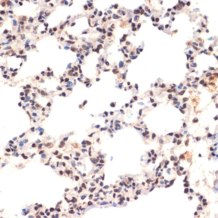 Immunohistochemistry - Anti-EHMT2/G9A Antibody [ARC2470] (A305253) - Antibodies.com