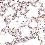 Immunohistochemistry - Anti-EHMT2/G9A Antibody [ARC2470] (A305253) - Antibodies.com