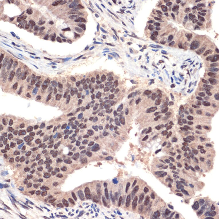 Immunohistochemistry - Anti-EHMT2/G9A Antibody [ARC2470] (A305253) - Antibodies.com